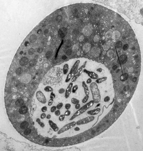 V.cholerae_Amoebae_EM