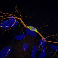 Neurons